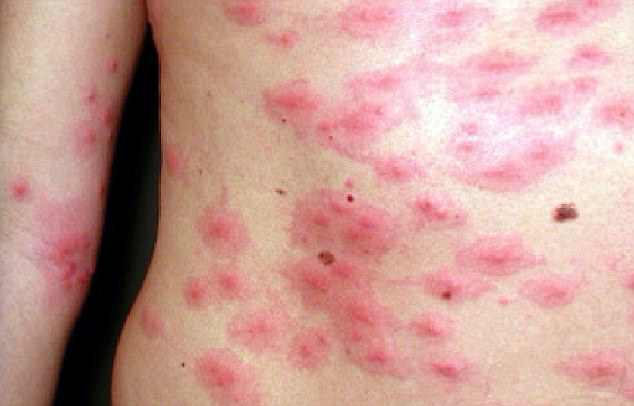 Юго-восток Великобритании заполонили опасные для человека гусеницы 1